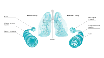 Confident-looking doctor sitting at desk with Vivatmo pro in background, holding up lung image as weather map with positive value.